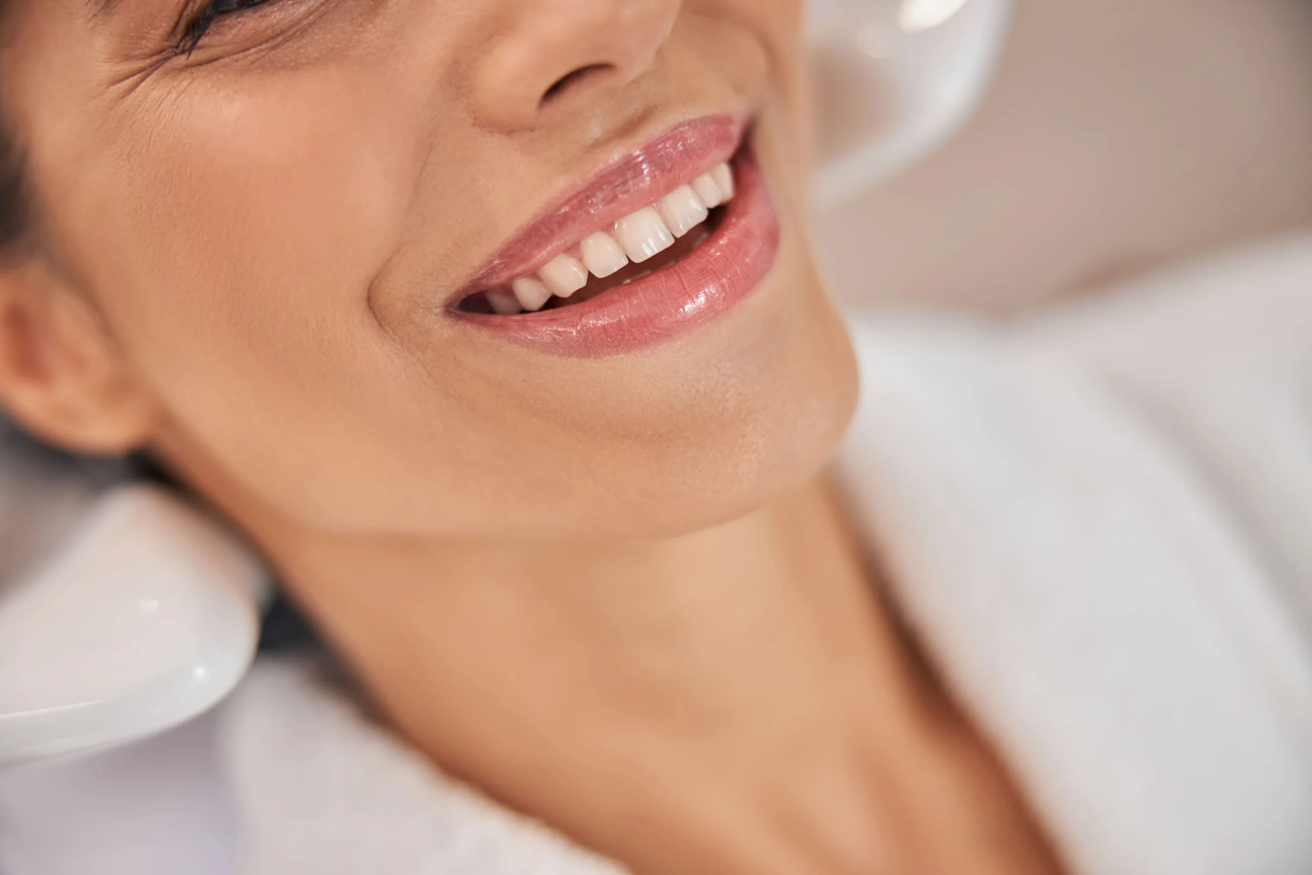 estetica dental