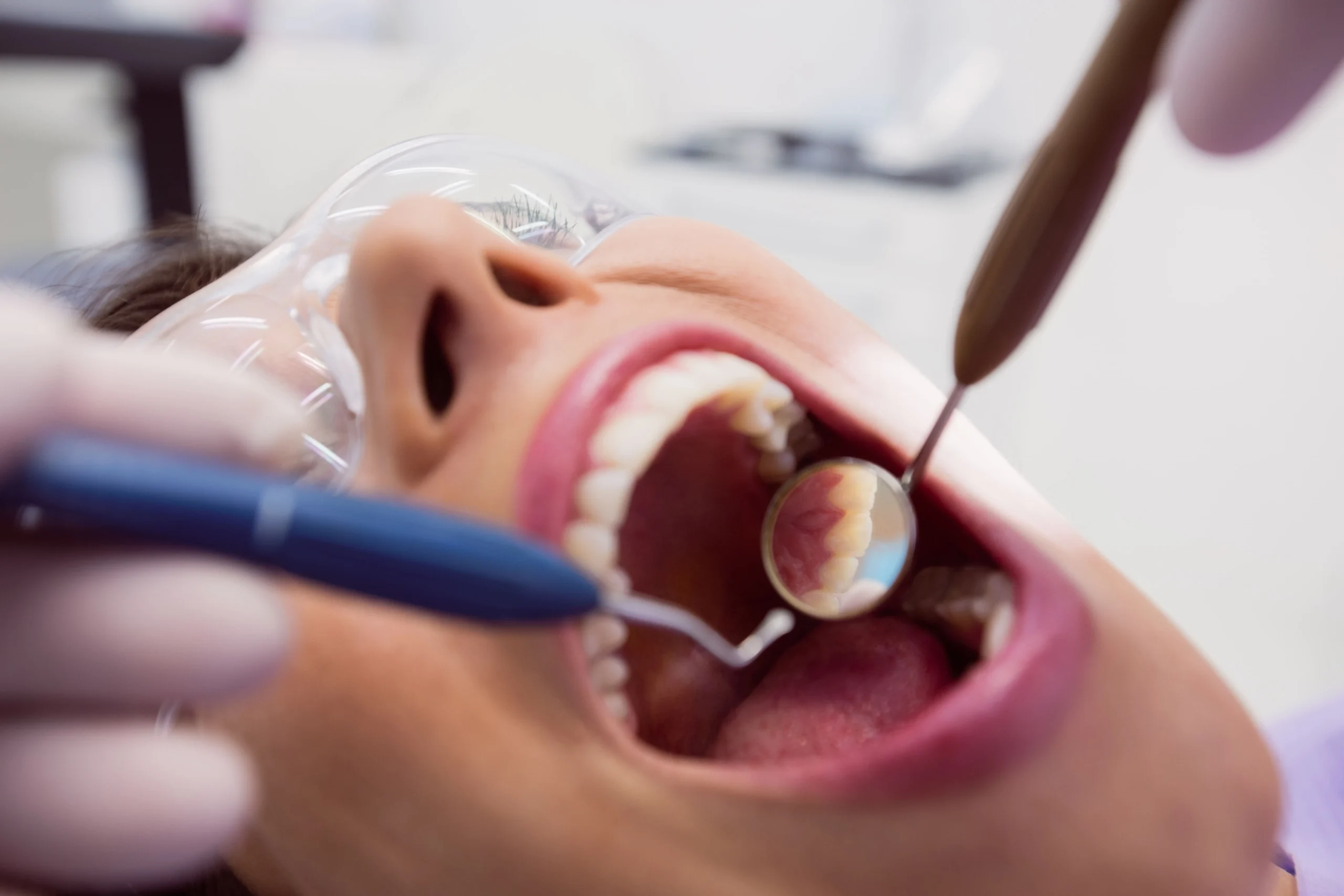 la endodoncia